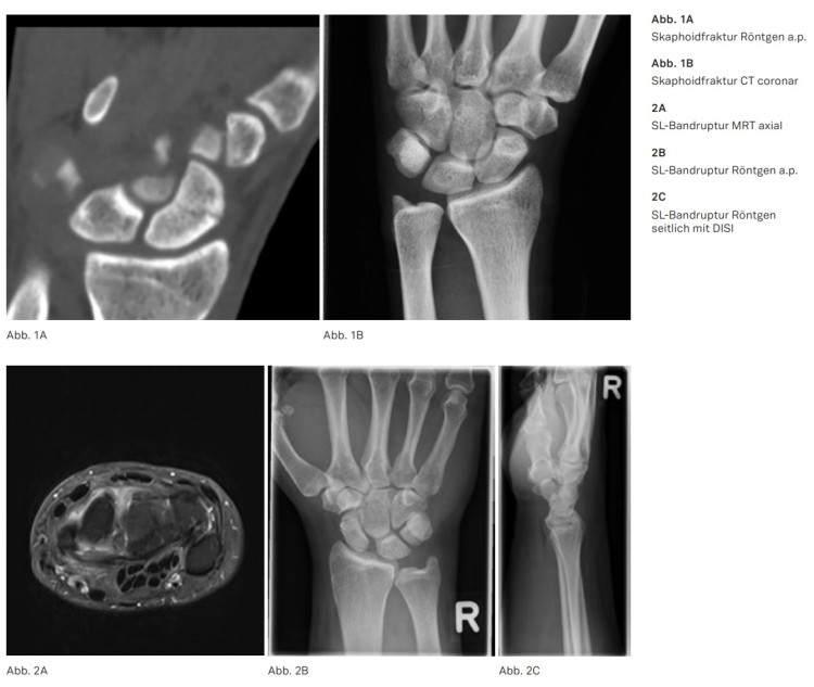 Mrt Handgelenk Muss Man Ganz In Die Röhre Hand in Hand mit der Radiologie – BVOU Netzwerk